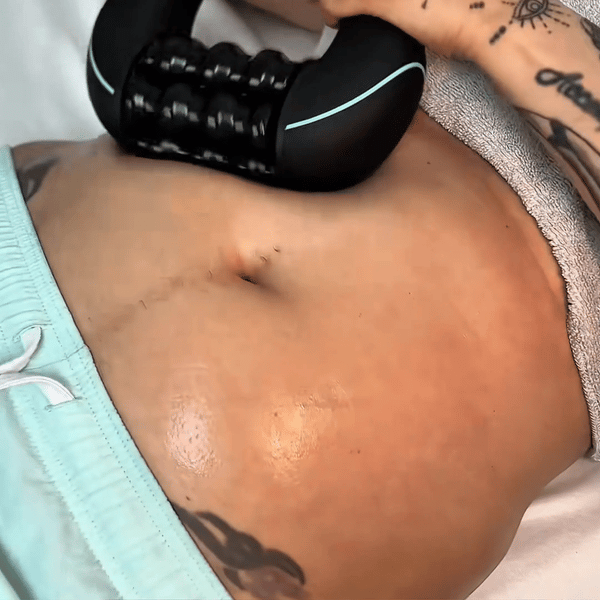 Body Melt™ Pro Roller